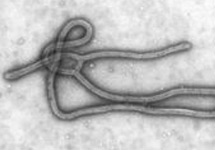 Вирус Эбола. Фото: Википедия