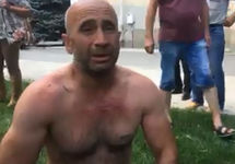 Активист после попытки самосожжения. Кадр видео "Крымской солидарности"