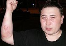 Томский активист Шульгин подвергся новым пыткам из-за попытки привлечь силовиков за прежние